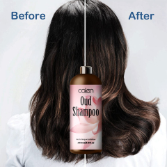 Oalen 250Ml Prevents Dandruff Nourishes Repairs Damaged Oud Shampoo,MY SHOP