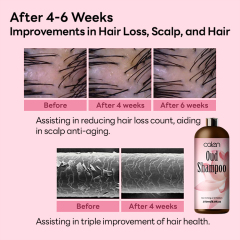 Oalen 250Ml Prevents Dandruff Nourishes Repairs Damaged Oud Shampoo,MY SHOP