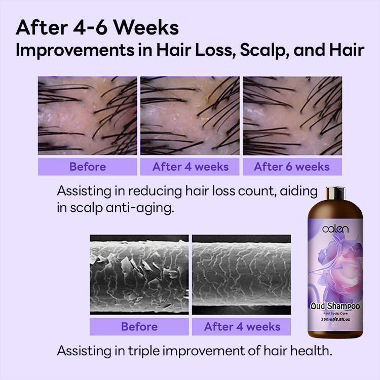 Luxfume 250Ml Manageable Reduces Promotes Hair Growth Oud Shampoo,MY SHOP