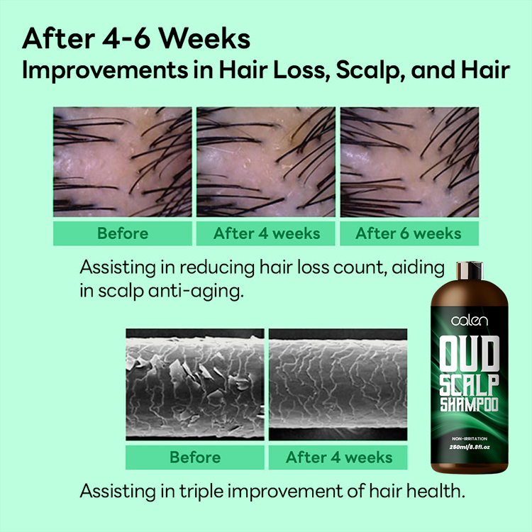 Oalen 250Ml Improves Hair Texture Visible Voulme Cleanses Oud Shampoo,oalen cosmetics