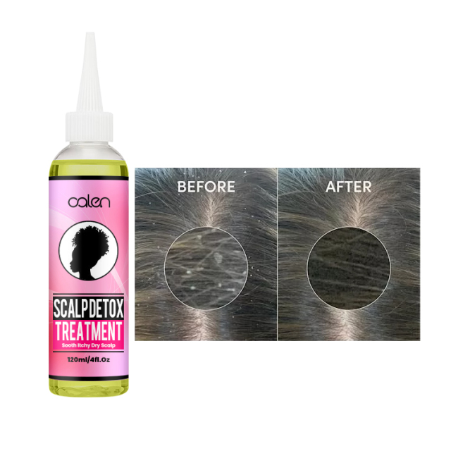 Oalen Custom Pre-Shampoo Scalp Oily Control Soothing Relief Detox,MY SHOP
