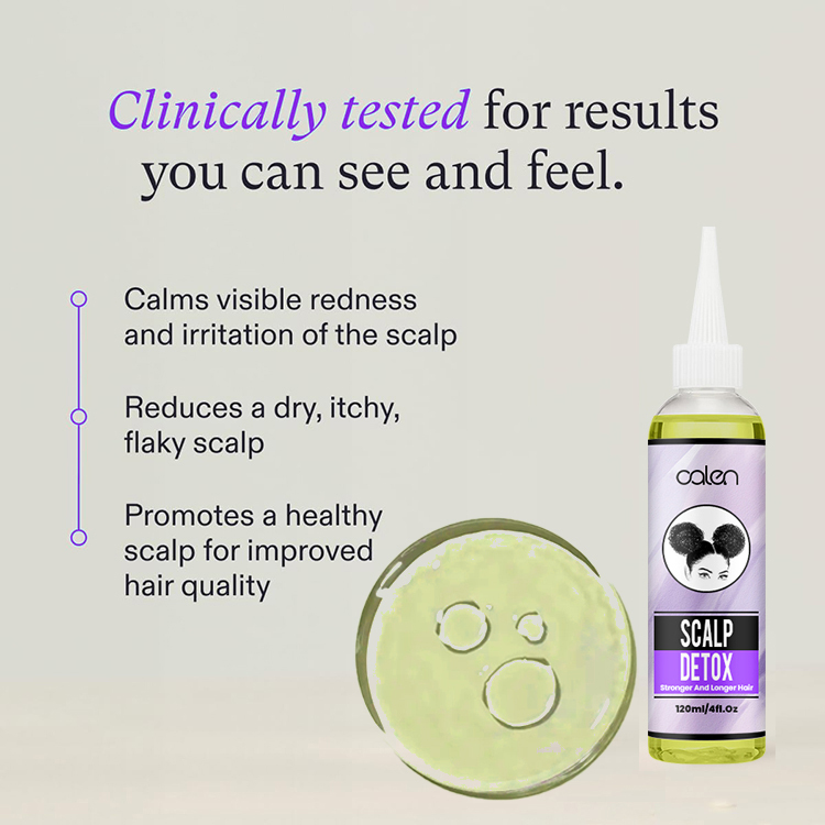 Oalen 120Ml Hair Loss Treatment Scalp Detox Hair Growth Oil,MY SHOP