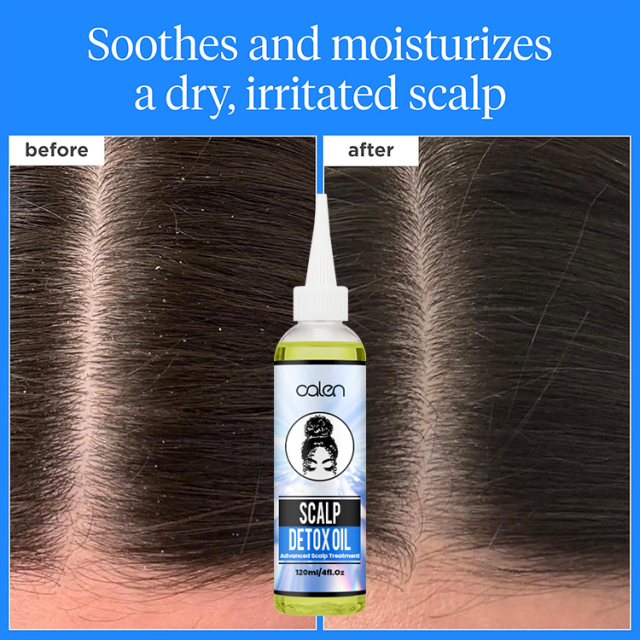Oalen ODM 120Ml Build-Up Shampoo Pre Cleanse Scalp Detox Tonic,oalen cosmetics