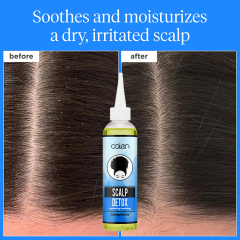 Oalen 120Ml Detox Scalp Repair Cleansing Used Before Shampoo,MY SHOP