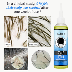 Oalen 120Ml Detox Scalp Repair Cleansing Used Before Shampoo,MY SHOP