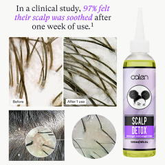 Oalen 120Ml Hair Loss Treatment Scalp Detox Hair Growth Oil,MY SHOP