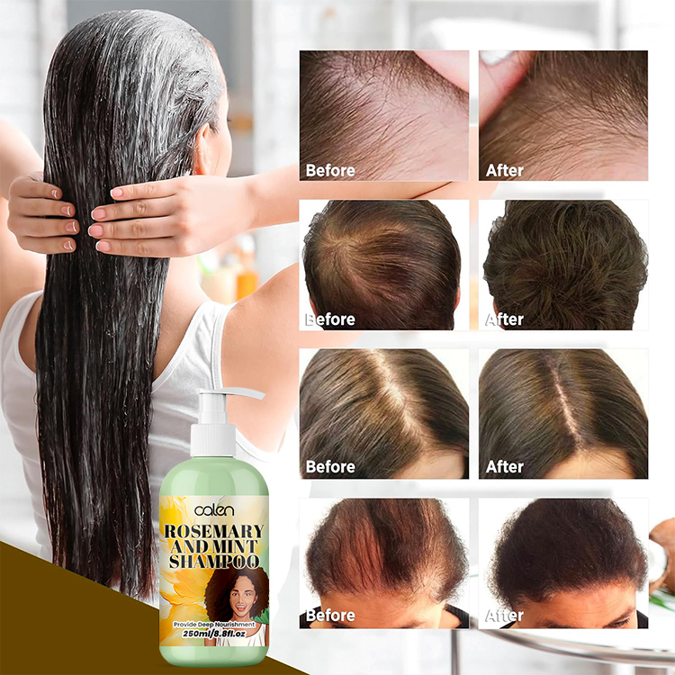 Oalen 250Ml Moisturizing Rosemary Growth Mint Strengthening Shampoo,MY SHOP