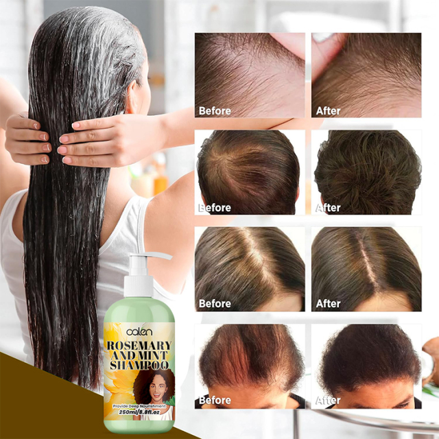 Oalen 250Ml Moisturizing Rosemary Growth Mint Strengthening Shampoo,MY SHOP