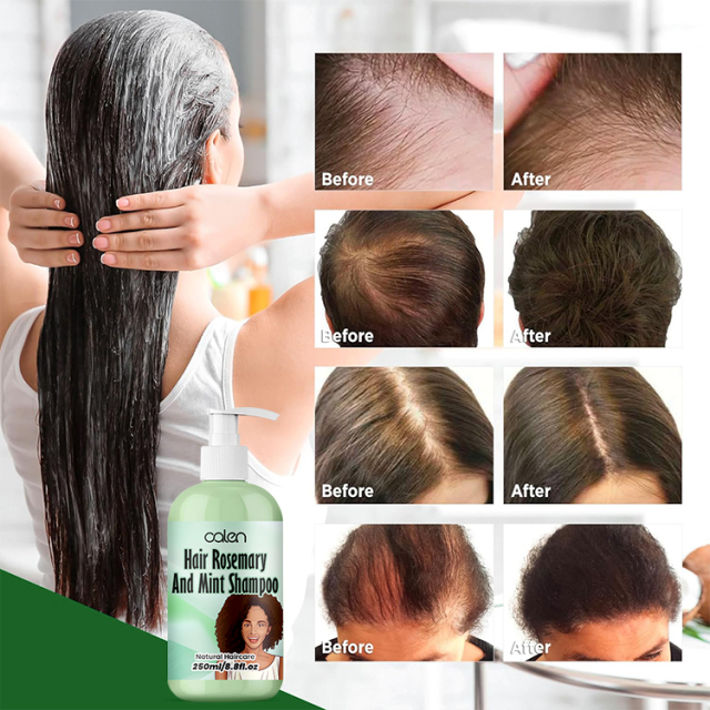 Oalen 250Ml Hair Growth Rosemary Oil Mint Strengthening Shampoo,MY SHOP