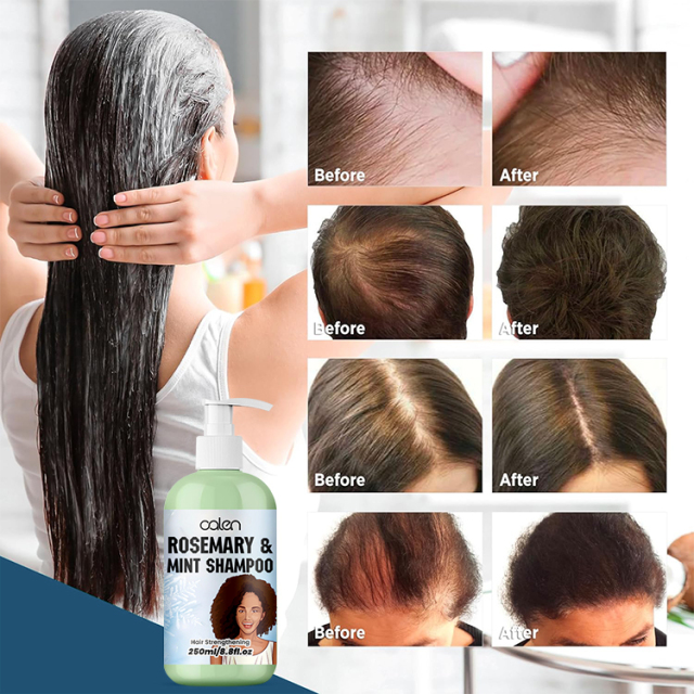 Oalen 250Ml Private Label Natural Herbal Daily Hair Growth Treatment Rosemary Mint Shampoo,oalen cosmetics