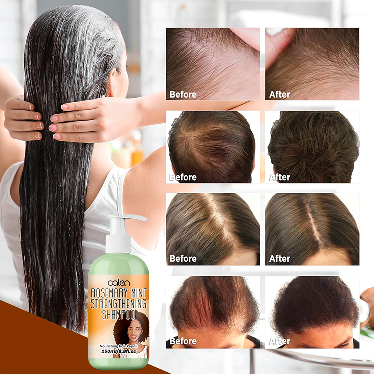Oalen 250Ml OEM ODM Hair Loss Treatment Rosemary Mint Hair Shampoo,MY SHOP