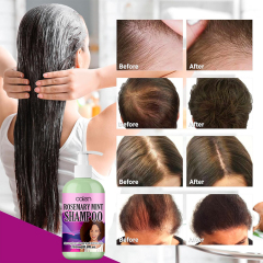 Oalen Customized 250Ml Grow Hair Strengthening Rosemary Mint Shampoo,MY SHOP
