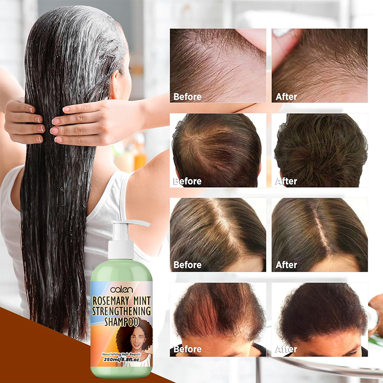 Luxfume 250Ml Thickening Anti Dandruff Contain Mint Rosemary Shampoo,MY SHOP