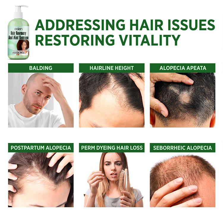 Oalen 250Ml Hair Growth Rosemary Oil Mint Strengthening Shampoo,MY SHOP