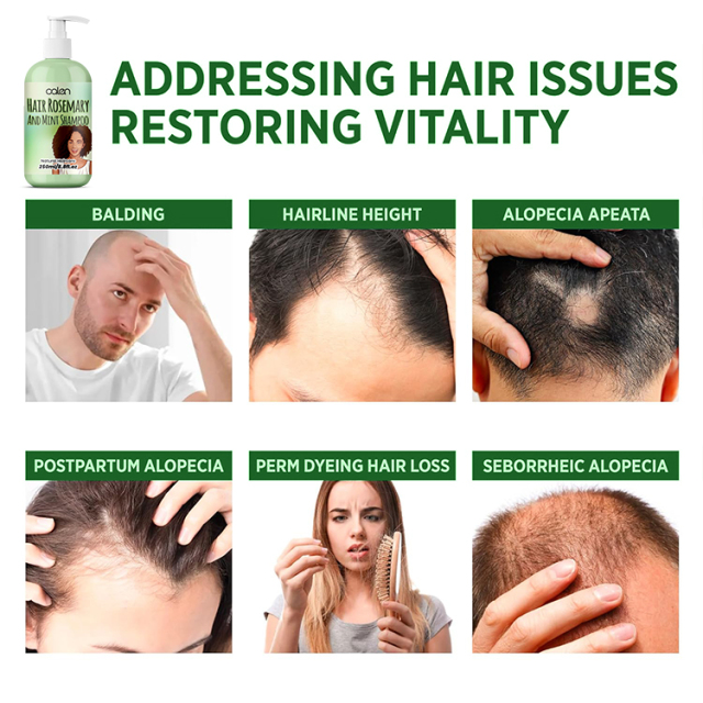 Luxfume OEM 250Ml Thickening Anti Hair Loss Rosemary Mint Shampoo,MY SHOP