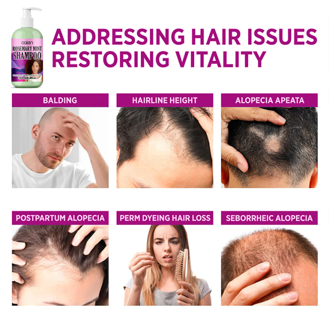 Oalen Customized 250Ml Grow Hair Strengthening Rosemary Mint Shampoo,MY SHOP
