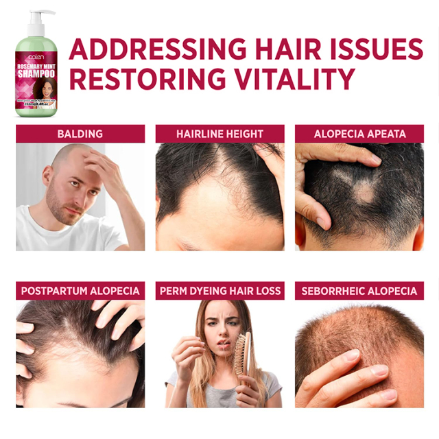 Luxfume 250Ml Hair Growth Nourishment Smoothness Rosemary Shampoo,MY SHOP