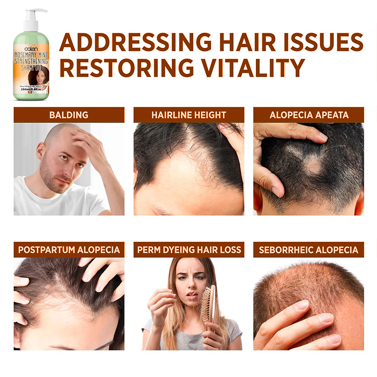 Oalen 250Ml OEM ODM Hair Loss Treatment Rosemary Mint Hair Shampoo,MY SHOP