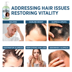 Oalen 250ml OEM ODM Nourishing Treatment Rosemary Mint Hair Shampoo,MY SHOP