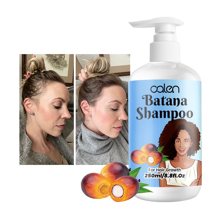 Luxfume 200Ml Enhances Organic Batana Oil Hair Growth Shampoo,MY SHOP