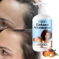 Oalen 250Ml OEM 100% Natural Hair Growth Raw Batana Oil Shampoo,MY SHOP