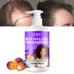 250ml Oalen ODM Scalp Nourishing Hair Growth Batana Oil Hair Shampoo,MY SHOP