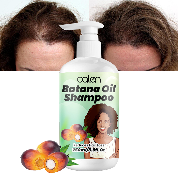 250Ml Oalen 100% Raw Hair Growth Repair Care Batana Oil Shampoo,MY SHOP