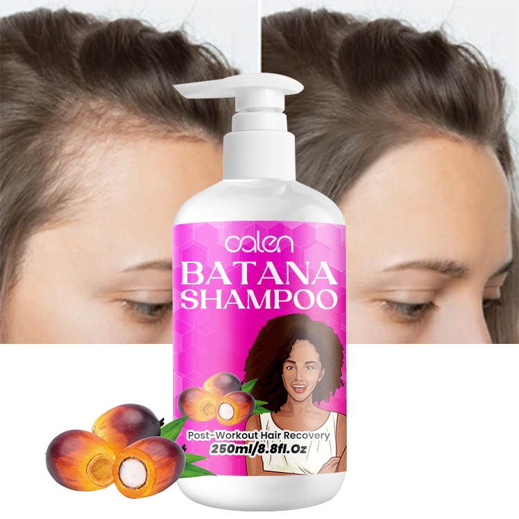 250Ml Luxfume Hair Growth Moisturizer Dandruff Control Batana Shampoo,oalen cosmetics