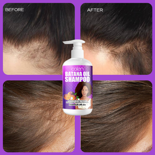 Luxfume 200Ml OEM ODM Strengthens Thickening Hair Batana Shampoo,MY SHOP