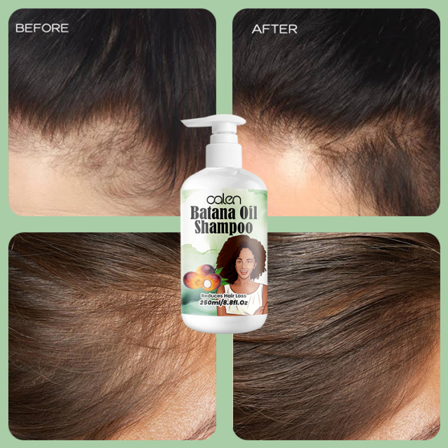 Luxfume 250Ml OEM Repair Nourishing Hair Growth Batana Oil Shampoo,MY SHOP