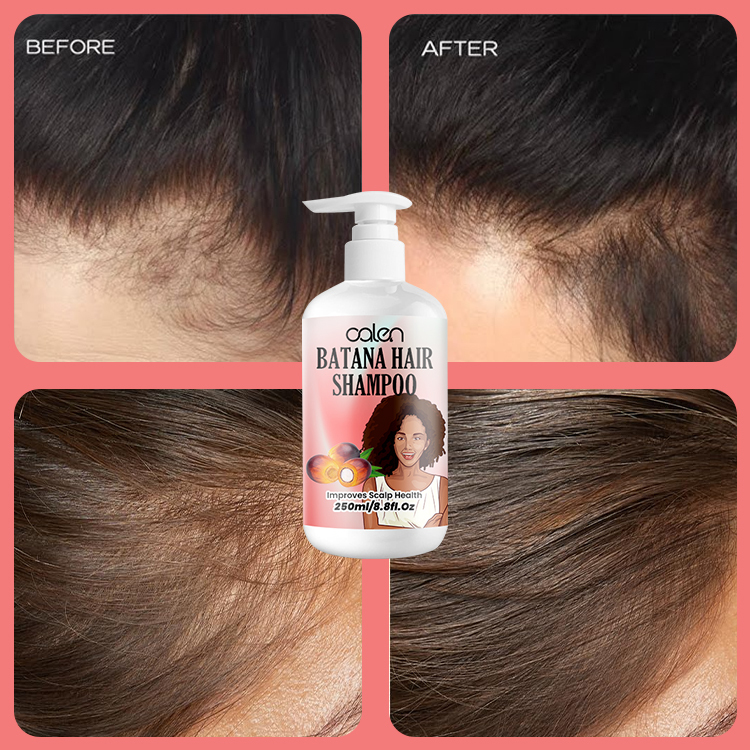 Oalen 250ml ODM OEM Damaged Hair Hair Growth Batana Hair Oil Shampoo,MY SHOP