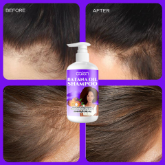 250ml Oalen ODM Scalp Nourishing Hair Growth Batana Oil Hair Shampoo,MY SHOP