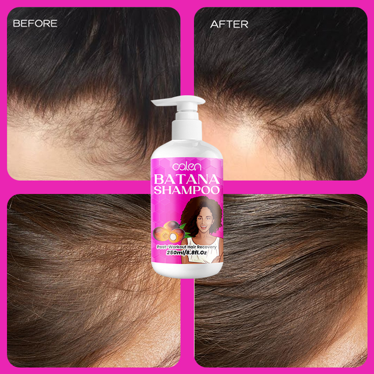 250Ml Luxfume Hair Growth Moisturizer Dandruff Control Batana Shampoo,oalen cosmetics