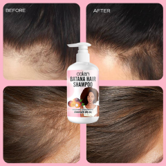 Oalen Custom Logo 250Ml Gentle Hair Care Hair Grow Batana Oil Shampoo,MY SHOP