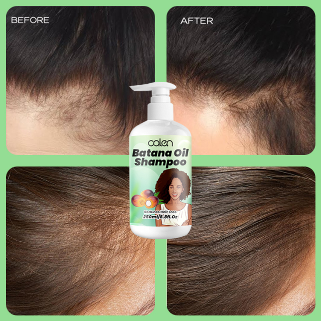 250Ml Oalen 100% Raw Hair Growth Repair Care Batana Oil Shampoo,MY SHOP