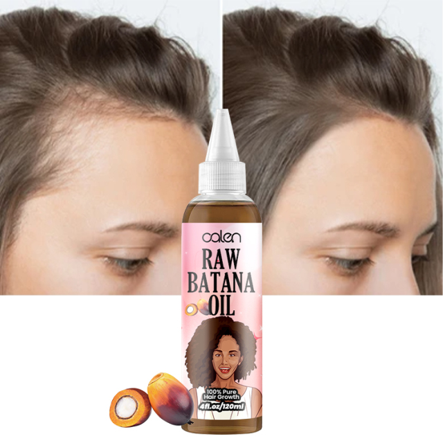 Luxfume 120Ml Private Label Hair Regrowth 100% Pure Raw Batana Oil,oalen cosmetics