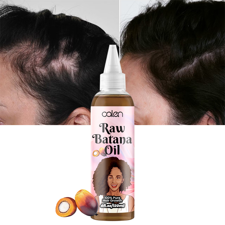 Oalen 120Ml Hair Scalp Pure Natural Raw Batana Oil For Hair Growth,oalen cosmetics