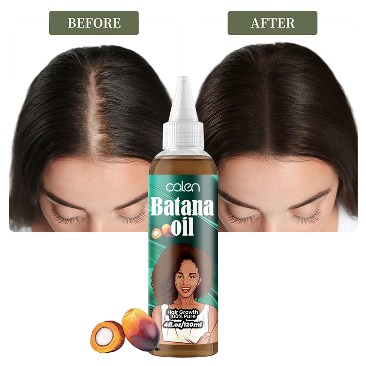 Oalen 120Ml Private Label Growth Hair Essential Batana Oil,oalen cosmetics