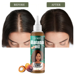 Oalen 120Ml Private Label Growth Hair Essential Batana Oil,oalen cosmetics