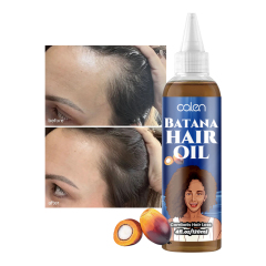 Oalen Custom Logo 250Ml Hair Growth Vegan Batana Oils Hair Serum,MY SHOP