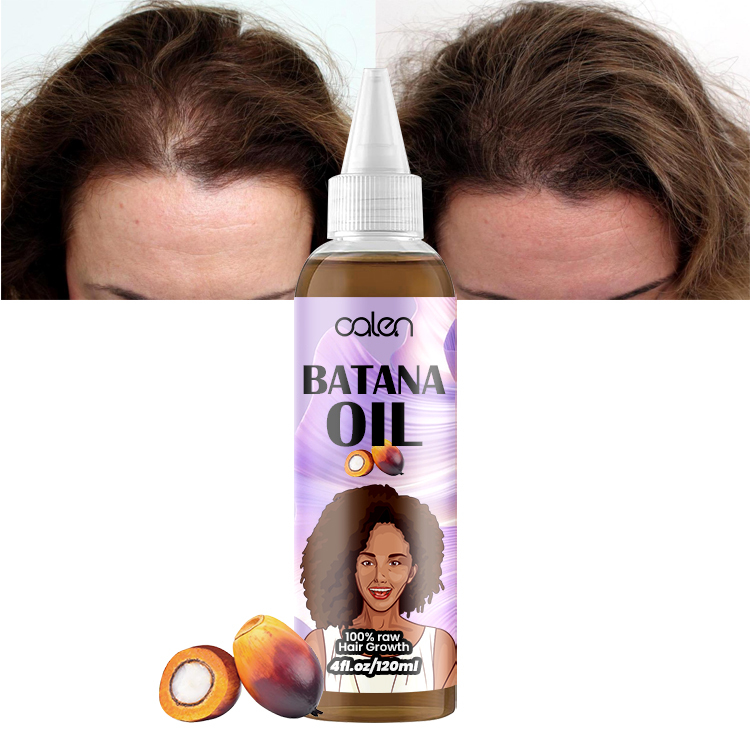 Oalen 120Ml Factory Vegan Hair Growth Batana Oil Strengthening Serum,oalen cosmetics