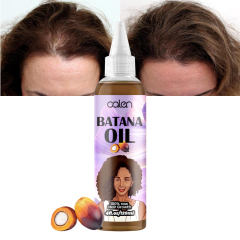 Oalen 120Ml Factory Vegan Hair Growth Batana Oil Strengthening Serum,oalen cosmetics