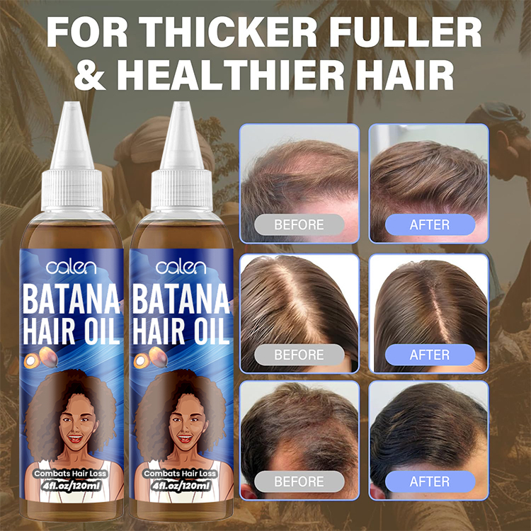 Oalen Private Label 100% Herbal Raw Hair Growth Batana Message Oil,MY SHOP
