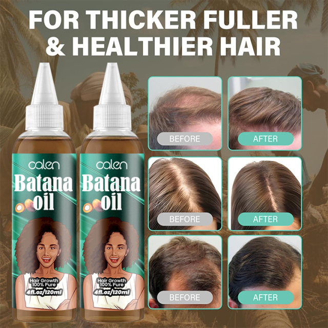 Oalen 120Ml Private Label Growth Hair Essential Batana Oil,oalen cosmetics