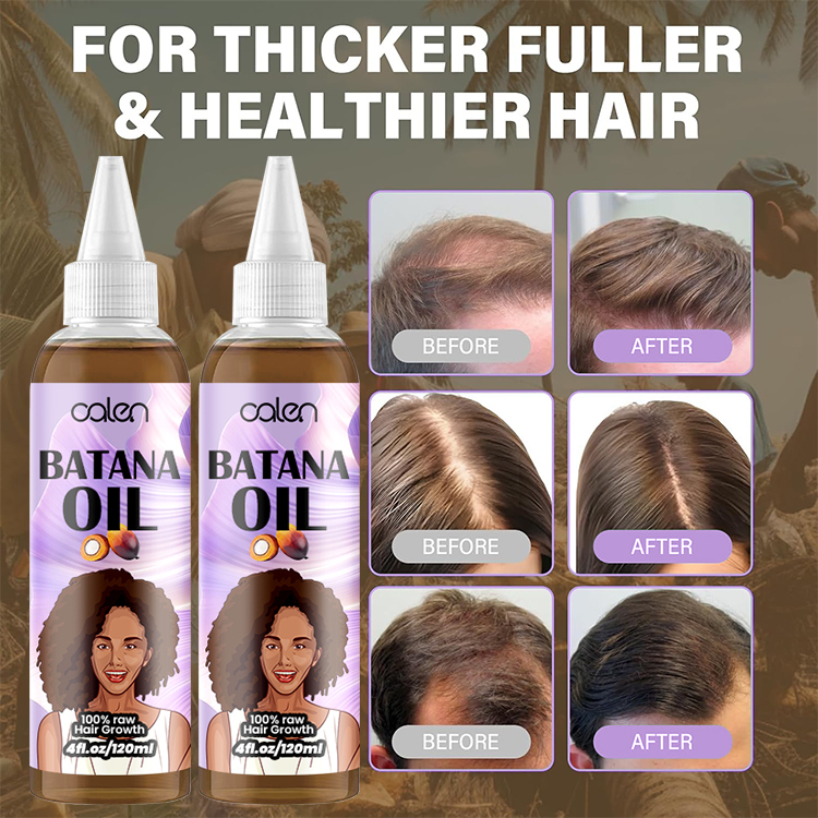 Oalen 120Ml Factory Vegan Hair Growth Batana Oil Strengthening Serum,oalen cosmetics