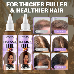 Oalen 120Ml Factory Vegan Hair Growth Batana Oil Strengthening Serum,oalen cosmetics