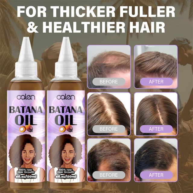 Oalen 120Ml Factory Vegan Hair Growth Batana Oil Strengthening Serum,oalen cosmetics