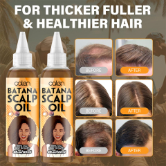 Oalen 120Ml Custom Logo Natural Anti Hair Loss Strengthen Batana Oil,MY SHOP
