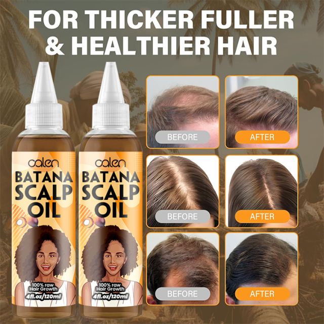 Oalen 120Ml Custom Logo Natural Anti Hair Loss Strengthen Batana Oil,MY SHOP