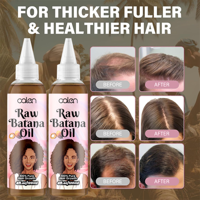 Oalen 120Ml Hair Scalp Pure Natural Raw Batana Oil For Hair Growth,oalen cosmetics